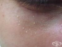 ����������� 3 ����� ������, �� �� ���������� ��������� �� ������