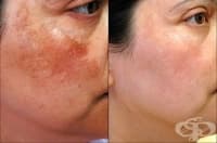 ��������� ����������� ����� �� ������ �� ��� ��� �� ����� � ����� �� �����