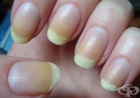 ����������� 3 �������� �������� ����� ����������� �� �������