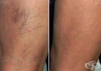 ����������� ������ �� ������ � �������� ����� ������� ��������