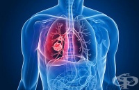 ��������� �� ������� ������ ����� ��������� �������