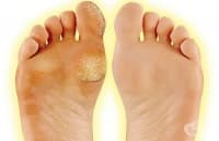 ���������� �������� �� ������� � ����� ��� ��������� �����