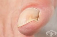 ���������� ��������� �� ������� ��� ����, ��������� ������� ����, ��� ��� �����