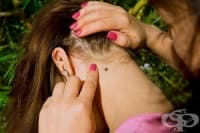 ���������� 5 �������, �� �� �� �������� �� �������