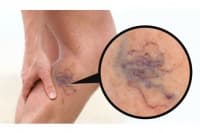 �������� �������������� ���� � 5 ��������� ��������