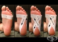 Спортен тейпинг при плантарен фасциит