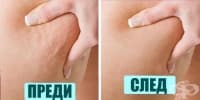 Тренировка за намаляване на целулита по бедрата