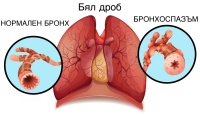Бронхоспазъм