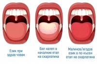 Бял ягодов език