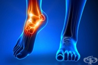 Болка в областта на глезена