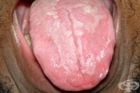 Грапав език