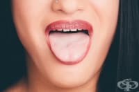 Изтръпване на езика