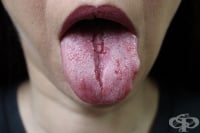 Набразден език