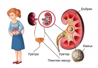 Обструкция (запушване) на пикочните пътища