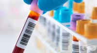 Повишена средна концентрация на хемоглобин в еритроцитите (MCHC)