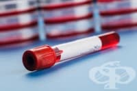 ��������-�������� ���������� ����