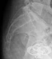 ���������� ������ �� �������� ����