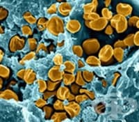 ���� �� ���������