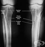 ������������� �� ����� �������