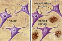 ���� �� ��������� �� ���� ������� �������