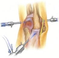 ����������� �� �����