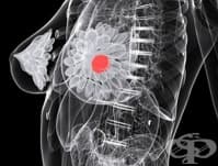 HER 2 ���� ��� ��� �� �������