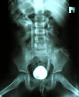 ��������� �����������