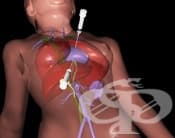 ������ �� ���������� �������