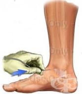 Артрография на глезен