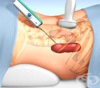 �������� �������