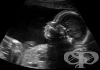 Ултразвуково изследване (ехография) по време на бременност