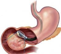 ����������� ���������