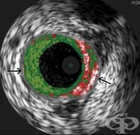 ��������������� ���������