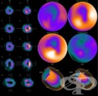 ���������� �� ����������� ��������