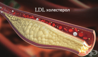   LDL-