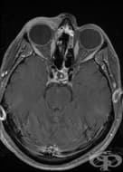 �������� �������� �� ������