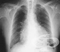 ��������������� ���������� �� ���������� �������