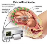 ���-�����-���� �� �����