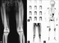 ������������� ���������� �� ����� (������ ������������)