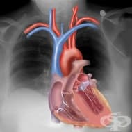 ���������� ���������� �� �������