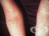 �������� ����