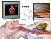 ���������������� ���������������