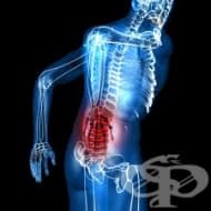 Облекчаване на болката