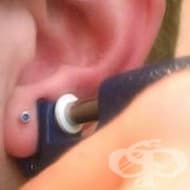 Избягвайте нехигиенични пиърсинг методи