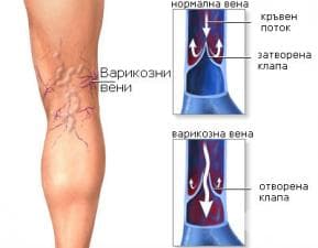 ������������ ������� �� ����������� ����