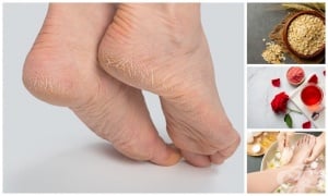 ������� ��� ��� �������� ����