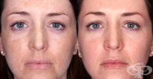 ������� �������� �� ����������� �� ���� �� ������