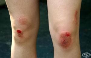 ���������� �� ������ - ����� � ����