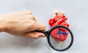 ����������� ���������� ��������� ������� ��-����� �� ������������� ������� �������