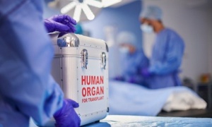 История на даряването на органи и на трансплантациите